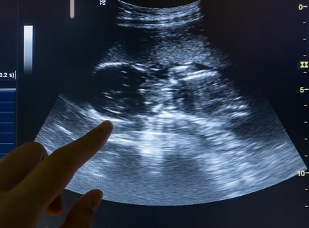 Diagnostic Medical Sonographer
